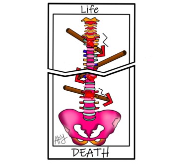 "La vie ou la mort?" başlıklı Dijital Sanat Ary tarafından, Orijinal sanat, Dijital Resim