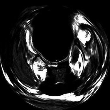 摄影 标题为“cancer 006” 由Johan Kause, 原创艺术品