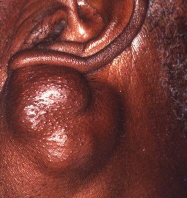 Photography titled "cancer 064" by Johan Kause, Original Artwork