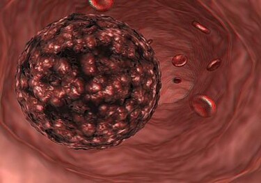 Photography titled "cancer 067" by Johan Kause, Original Artwork