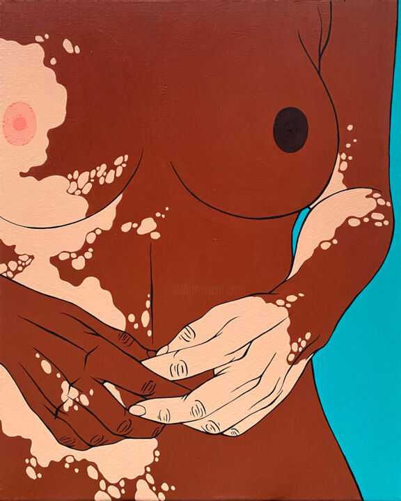 Gerda / Vitiligo beauty 绘画, 19.7x15.8 in