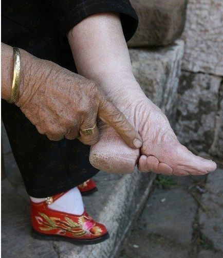 Photography titled "中国女人的裹小脚" by Liu Kai, Original Artwork