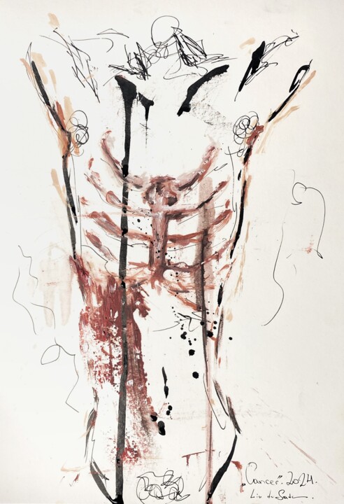Cancer 图画, 11.7x8.3 in
