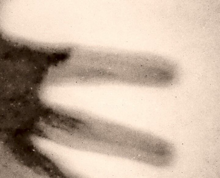 Details