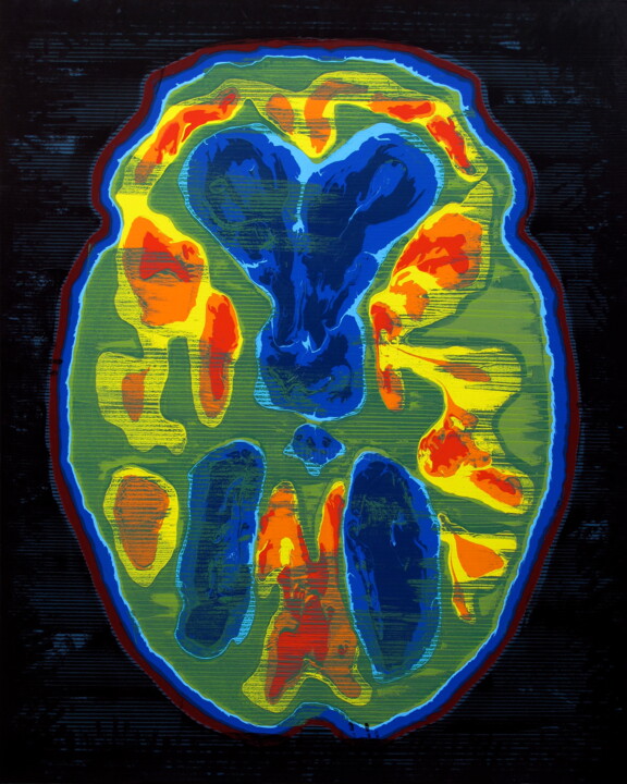 Schilderij getiteld "Brain Y. K." door Markus Honerla, Origineel Kunstwerk, Lak Gemonteerd op Frame voor houten brancard