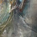 Detalles